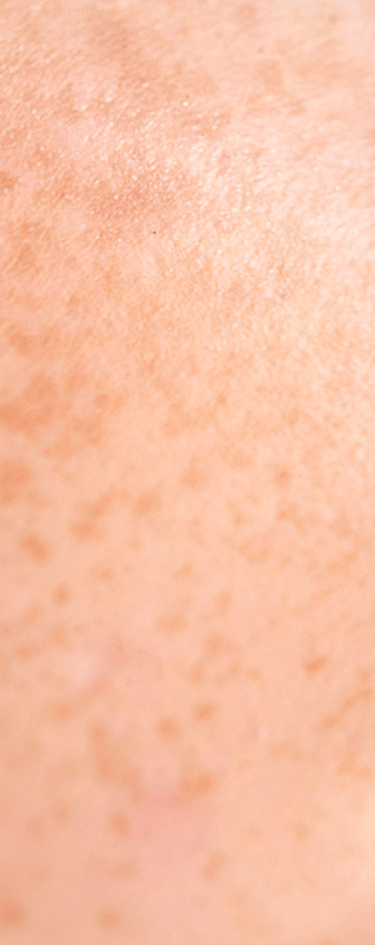 Mobile-Skin-1.jpg