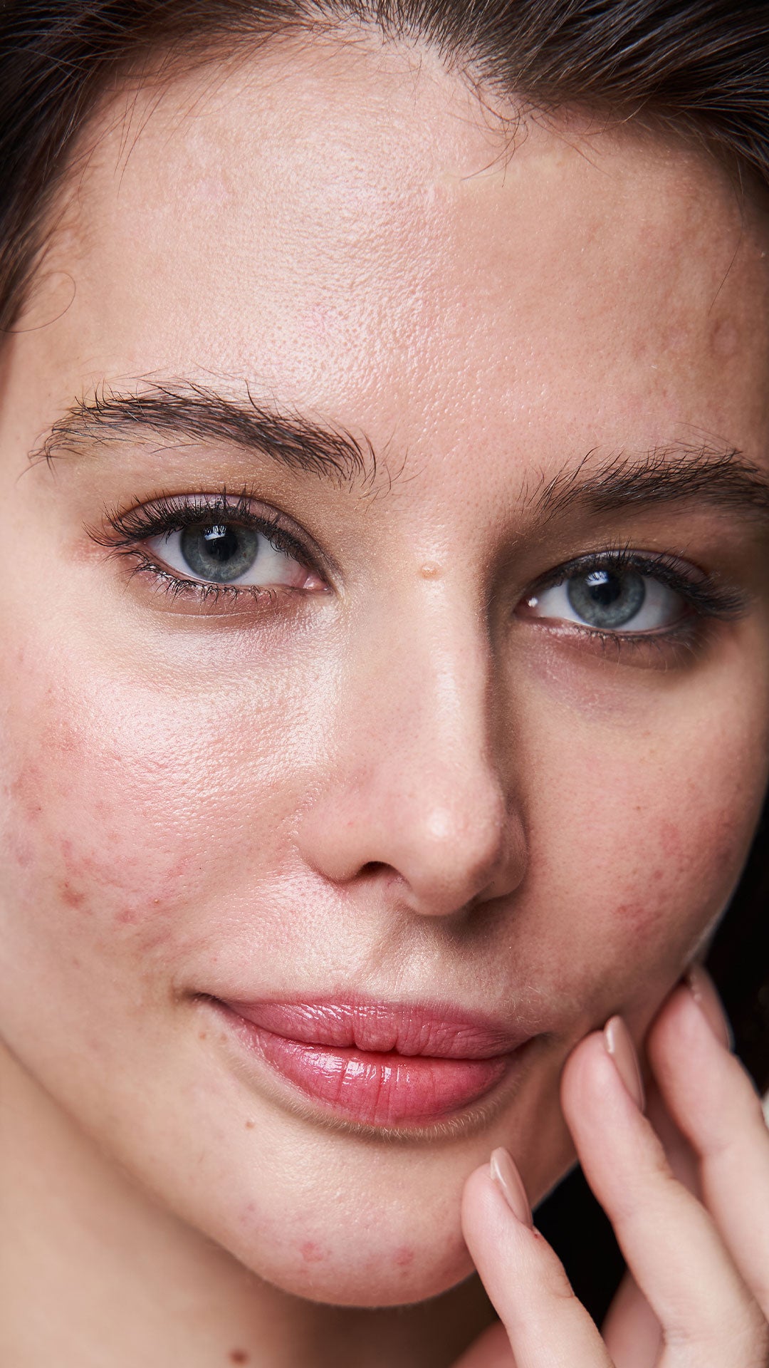 Catégorie pour l'acné, produits ciblant les imperfections et régulant l'excès de sébum, skincare coréenne | Acne category, products targeting blemishes and controlling excess oil, Korean skincare